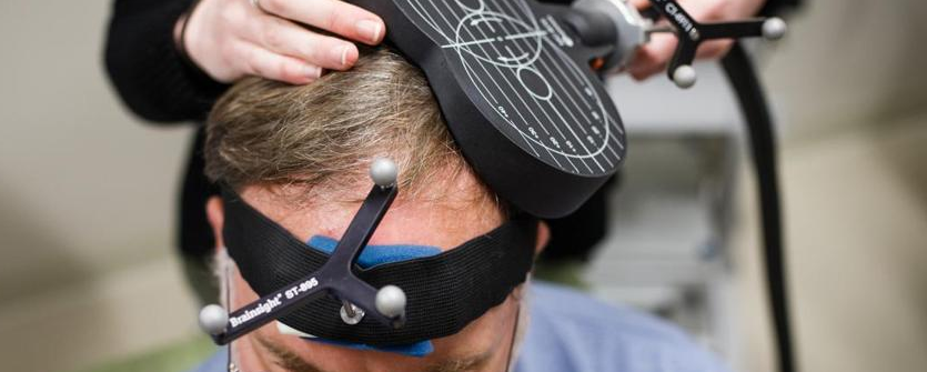 TMS for Major Depressive Disorder